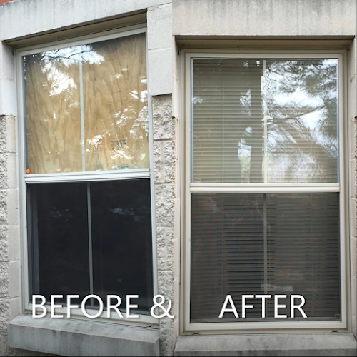 35977 glass screen hospital 1